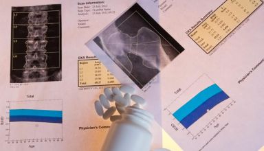 Homem depois dos 30: porque tomar cálcio é importante