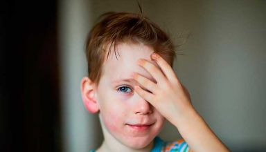 Dermatite em crianças