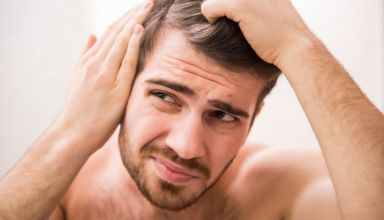 queda-de-cabelo-masculino