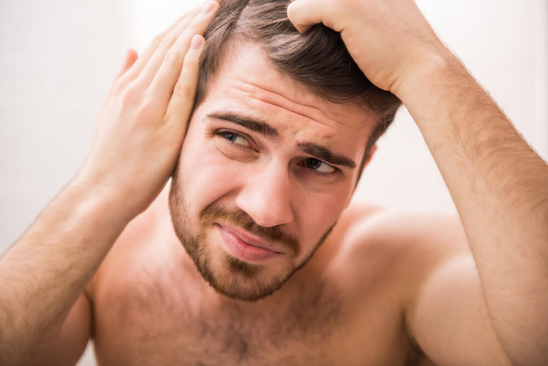 Queda de cabelo masculino: o que fazer para evitar? Queda de cabelo masculino: o que fazer para evitar?