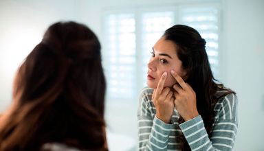 espinhas-no-rosto-o-que-voce-precisa-saber-sobre-elas