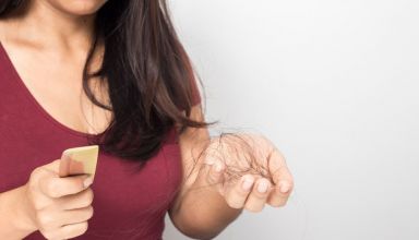 Alfaestradiol: confira o que você deve saber sobre ele!