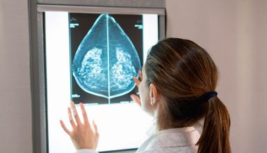 O que é anastrozol e para que serve esse medicamento