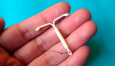 O que é Mirena e como deve ser colocado