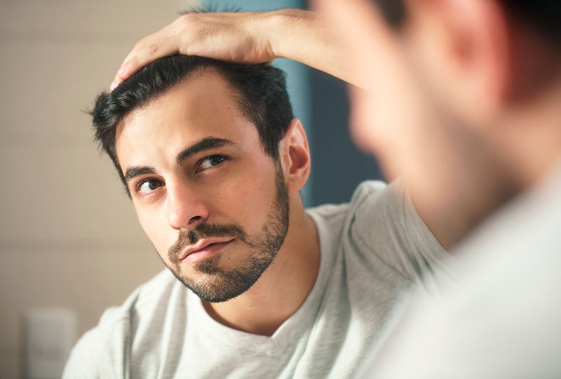 Como evitar a calvície e pare de sofrer com esse problema